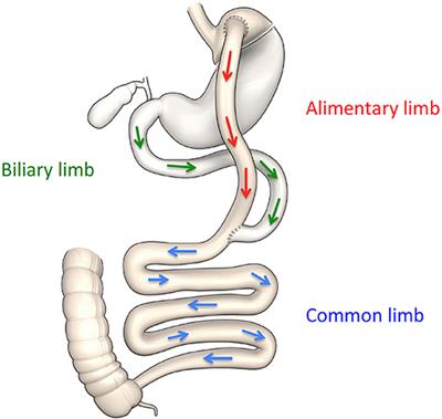 Weight-Independent Mechanisms of Glucose Control After Roux-en-Y Gastric Bypass